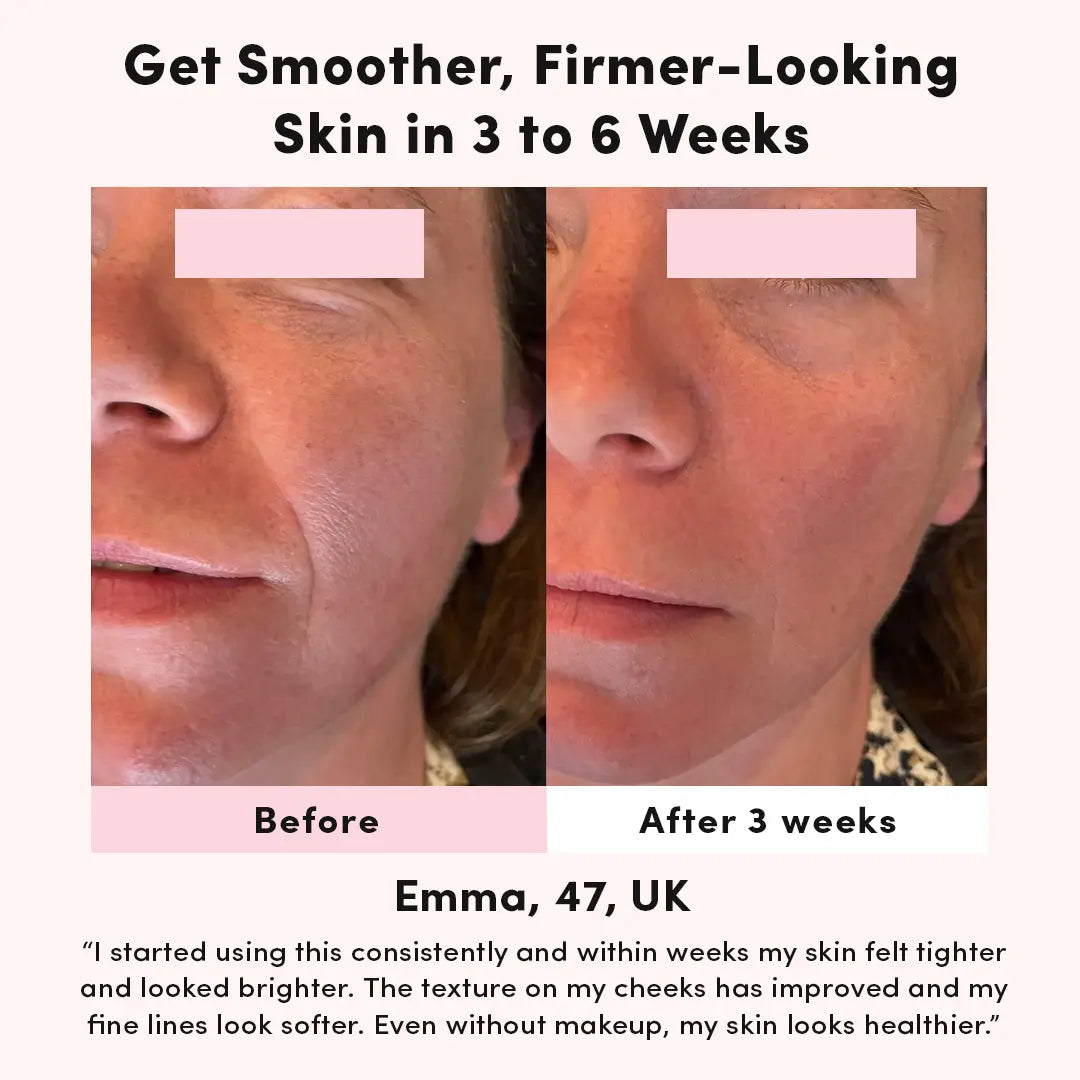 Baguette de Soin Haute Fréquence pour le Visage – Appareil Anti-Imperfections